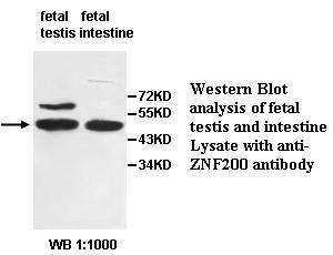 Anti-ZNF200 Antibody