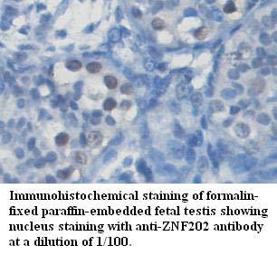 Anti-ZNF202 Antibody