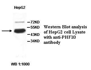 Anti-PHF10 Antibody