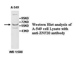 Anti-ZNF20 Antibody