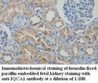 Anti-IQCA1 Antibody