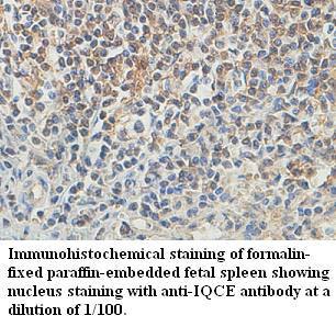 Anti-IQCE Antibody