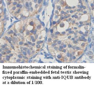 Anti-IQUB Antibody