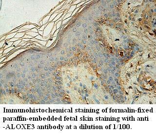 Anti-ALOXE3 Antibody