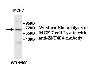 Anti-ZNF404 Antibody