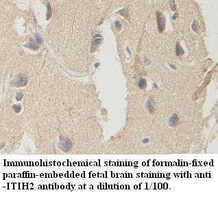 Anti-ITIH2 Antibody