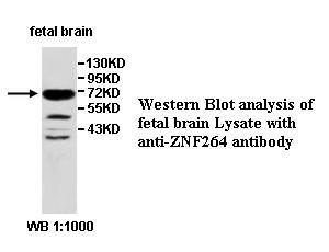 Anti-ZNF264 Antibody