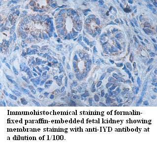 Anti-IYD Antibody