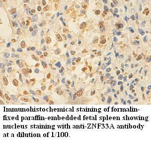 Anti-ZNF33A Antibody