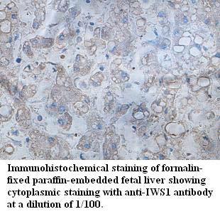 Anti-IWS1 Antibody