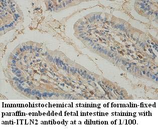 Anti-ITLN2 Antibody