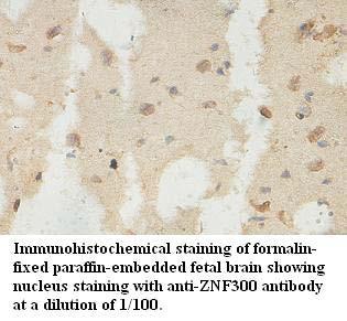 Anti-ZNF300 Antibody