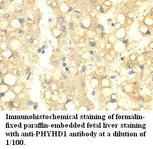 Anti-PHYHD1 Antibody