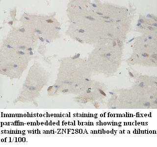 Anti-ZNF280A Antibody