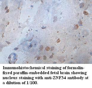 Anti-ZNF34 Antibody