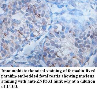 Anti-ZNF331 Antibody