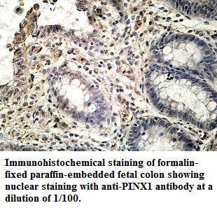 Anti-PINX1 Antibody