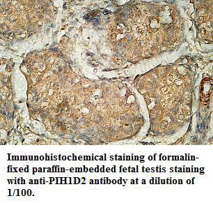 Anti-PIH1D2 Antibody
