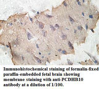 Anti-PCDHB10 Antibody
