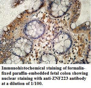 Anti-ZNF223 Antibody