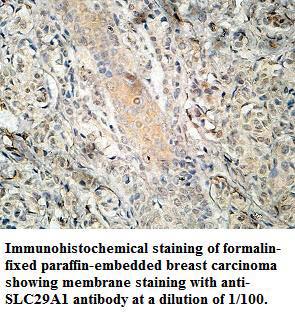 Anti-SLC29A1 Antibody