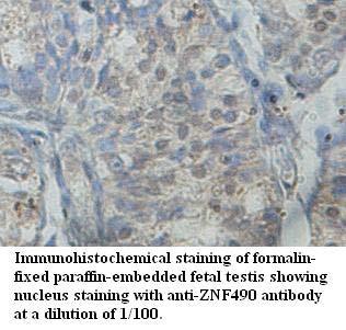 Anti-ZNF490 Antibody