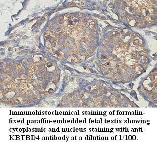 Anti-KBTBD4 Antibody