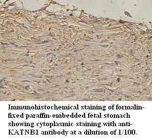 Anti-KATNB1 Antibody