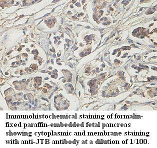 Anti-JTB Antibody