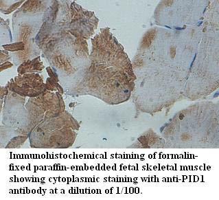 Anti-PID1 Antibody