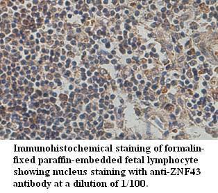 Anti-ZNF43 Antibody