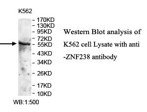 Anti-ZNF238 Antibody