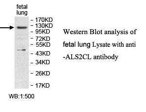 Anti-ALS2CL Antibody