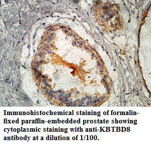 Anti-KBTBD8 Antibody
