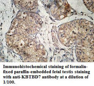 Anti-KBTBD7 Antibody