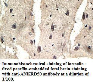 Anti-ANKRD50 Antibody