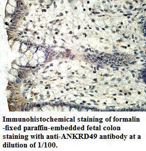Anti-ANKRD49 Antibody