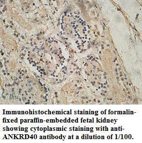 Anti-ANKRD40 Antibody