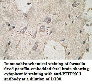 Anti-PITPNC1 Antibody