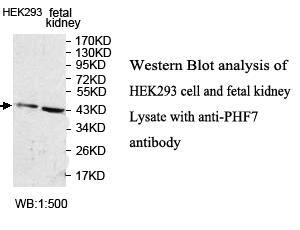 Anti-PHF7 Antibody