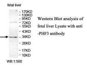 Anti-PHF13 Antibody