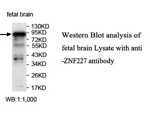 Anti-ZNF227 Antibody