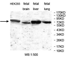 Anti-JAKMIP1 Antibody