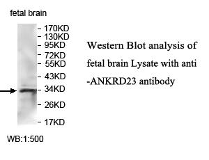 Anti-ANKRD23 Antibody