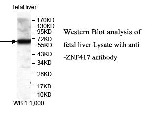 Anti-ZNF417 Antibody