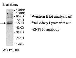 Anti-ZNF320 Antibody