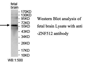 Anti-ZNF512 Antibody