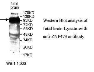 Anti-ZNF473 Antibody