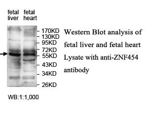 Anti-ZNF454 Antibody