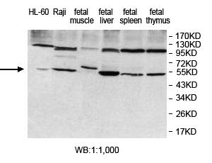 Anti-KDELC1 Antibody